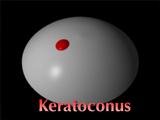 (1996 Siggraph Electronic Theatre OPTICAL Visualization Scene 07 called Keratoconus)