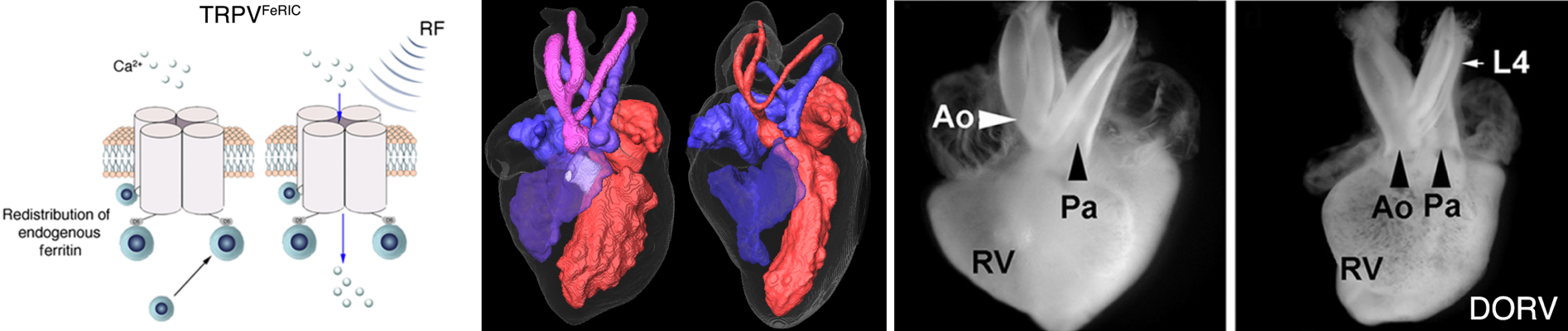 FeRIC
            mimics heart defects